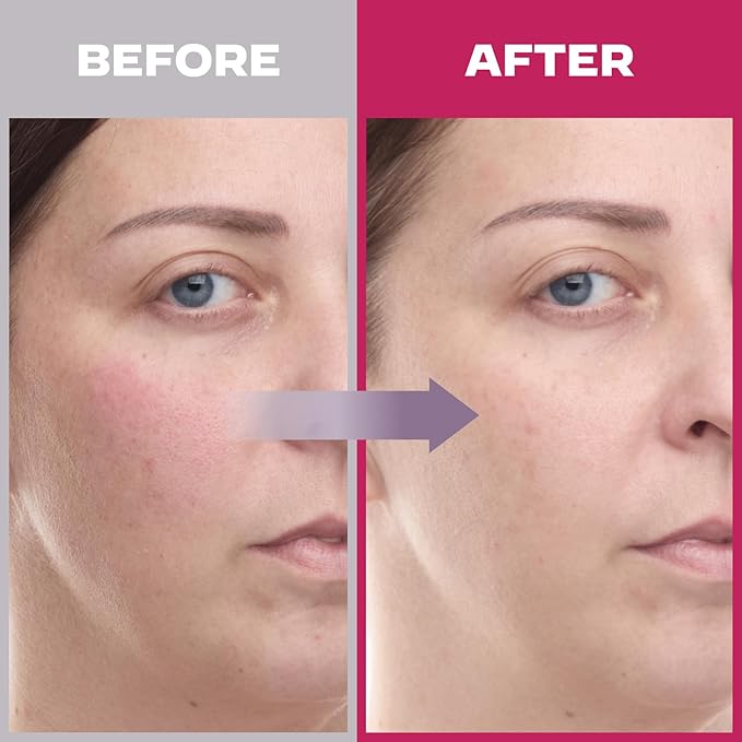 Wrinkle Care Duo : Superform Galvanic Booster Blush Pink and Glasslike Triple Power Wrinkle Spot Ampoule, 0.47fl. oz