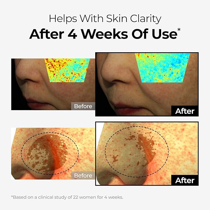 DOMINAS Dark Spot Corrector Cream | Advanced Formula with Niacinamide, TXA, Hexylresorcinol & Bakuchiol to Visibly Reduce Age Spots, Sun Spots & Uneven Tone | Korean Skincare (1.76 oz)