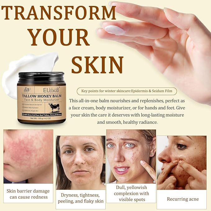 Whipped Tallow Cream for Face & Body - 100% Grass-Fed Beef Tallow, Natural Honey & Beeswax Moisturizer, Deep Hydration & Nourishment, Oil-Free & Unscented, Fast Absorbing