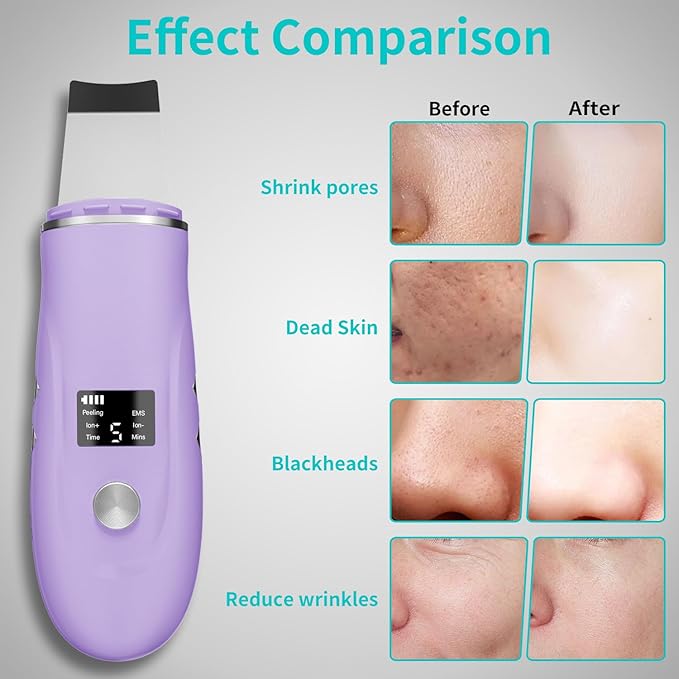 Skin Scrubber Facial Spatula - 4-in-1 Deep Cleansing Tool for Pore Extraction, Fast Charging Dock Blackhead Remover Face Spatula for Facial Skincare Women Gift (Purple)