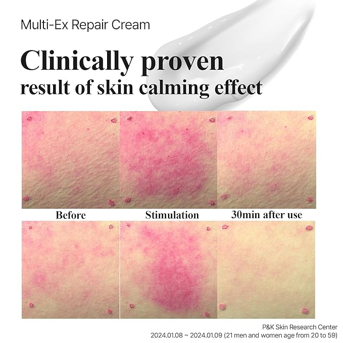 Multi-Ex Repair Cream 50ml – Korean Face Moisturizer with Niacinamide & EGF | Skin Repair Cream for Sensitive Skin | Soothing Facial Moisturizer for Women | Hydrating Moisture
