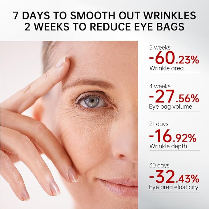 Retinol & Caffeine Eye Serum -360° Massage Roller for Puffiness,Eyebag Remover,Wrinkle Filler,Under Eye Cream For Dark Circles 0.54fl.oz (Pack of 2)