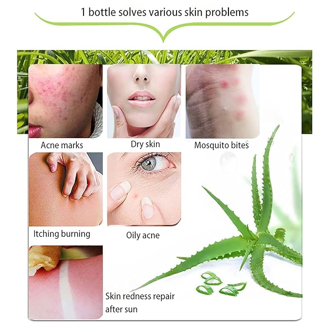 300 ML Natural Aloe Vera Gel -Organic Moisturizing Cream, Soothing and Hydrating, Sunburn and Scar Repair, Care for Face Body Hair