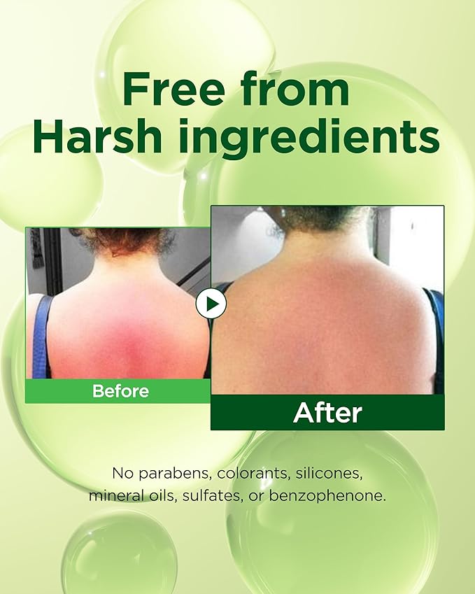 A'SOME After Sun Aloe Soothing Gel Korean Multi-Purpose Cooling Moisturizer with 99% Aloe Vera and Cica for Face Hair & Body for Dry Sensitive Skin, Non-Sticky Formula Free from Parabens, 6.8fl.oz