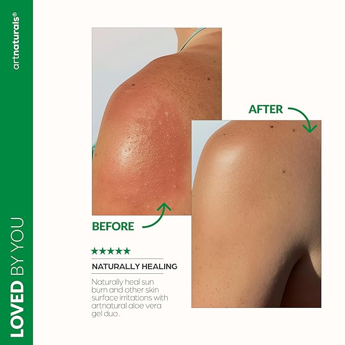 artnaturals Aloe Vera Gel Set - JUMBO 20oz - Sunburn Relief & Hydration for Face, Body, Scalp & Hair - Calming Moisturizer After Sun Exposure - Freshly Harvested within 12 Hours