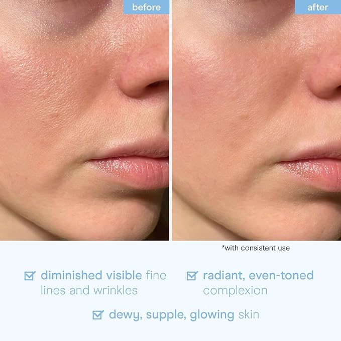 Baebody Snail Mucin Serum Moisturizer 3.38 fl.oz 100ml, Hydrating Serum for Face with Collagen - Snail Mucin Moisturizer For Youthful Smooth Skin