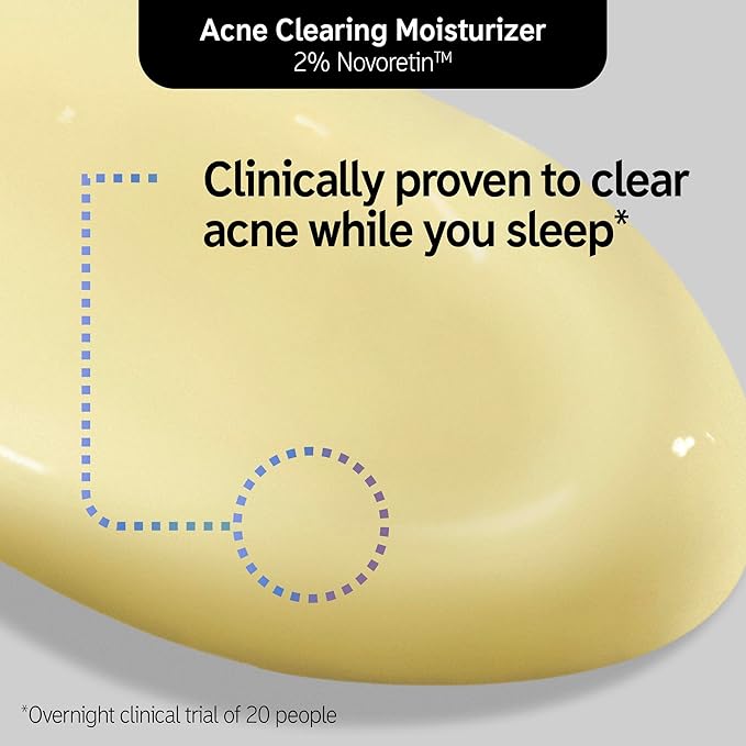 The INKEY List SuperSolutions Novoretin 2% Moisturizer, Skin Clearing Moisturizer to Reduce Blemishes and Breakouts While You Sleep, Non-Comedogenic 1.69 fl oz
