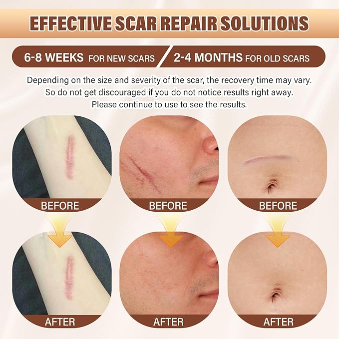 Silicone Scar Sheets,Silicone Scar Tape,Silicone Sheets