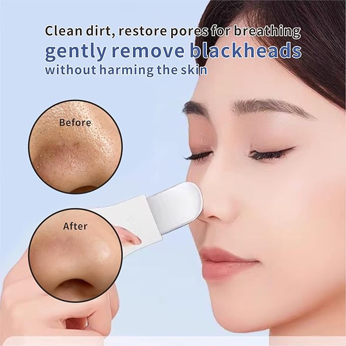 REVEX Nose Blackhead Remover Tool Set,Blackhead Scraper Tool,2Pcs Pore Cleaning Brush, Face Scrubber Skin Spatula, Pore Scrubber for Deep Cleansing,Face Exfoliator Scrubber for Women Men. (White)