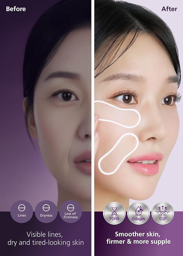 Easyderm PDRN Patch - Under Eye & Smile Line Care, 4 Patches, K-Beauty Korean Skincare with Collagen & EGF, Smile lines treatment, PDRN Eye mask, Special care, Stocking Stuffer Holiday Gift