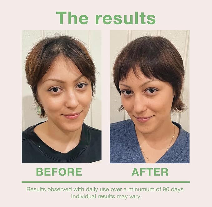 mumms Scalp Serum, Hair Growth Treatment with Saw Palmetto and Ginger Root, 2 fl oz, Daily Use