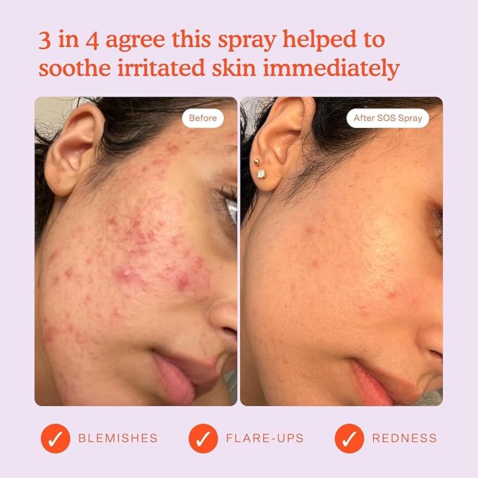 Tower 28 SOS Daily Rescue Spray Duo for Sensitive Skin, Hypochlorous Acid Spray Helps Reduce Redness and Breakouts, Full Size and Travel Size