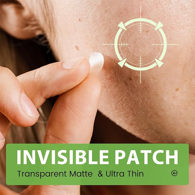 Pimple Patches with Hydrocolloid & Tea Tree – Korean Skincare Invisible Acne Stickers for Face, Oil-Absorbing Zit Dots, Vegan & Cruelty-Free Blemish Treatment, 50 Count (10mm/12mm/14mm)