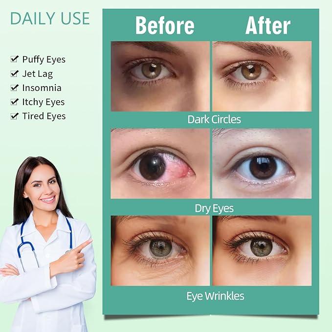 Serfeymi 22 packs steam eye