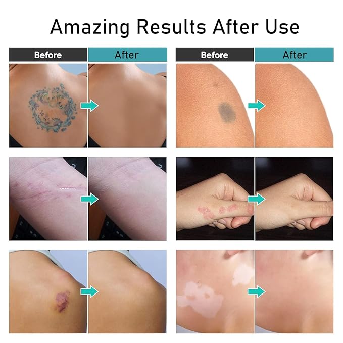 Tattoo Cover Up Makeup Waterproof,Makeup Cover Up,Tattoo Concealer,Leg,Body Makeup Waterproof No Transfer,Coverage Perfector (02 Deep)