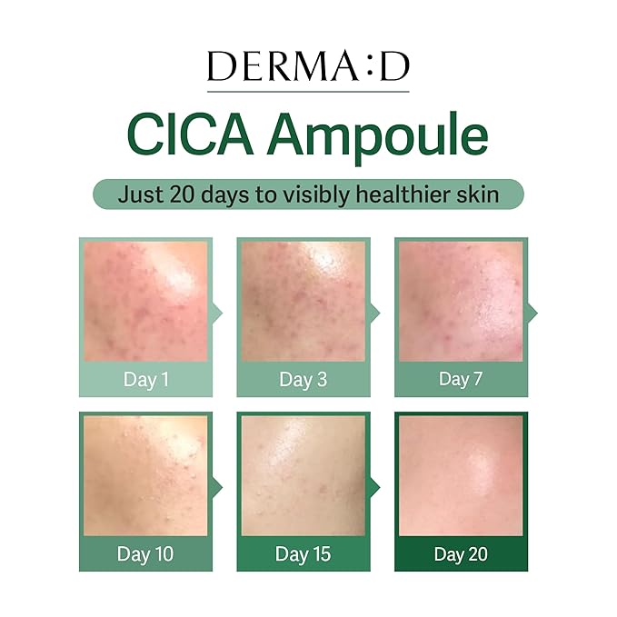 CICA Repair Ampoule (1.69 fl oz) - Calming & Hydrating Korean Face Serum with Hyaluronic Acid, Beta-Glucan, Propolis & Madecassoside. Lightweight K-Beauty Ampoule for Redness & Sensitive Skin