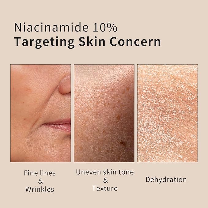 Epielle Complex Niacinamide 10% + Peptides Serum 3 fl.oz, Glowing and Firming Formula for Uneven Tone & Enlarged Pores, Anti-Aging Serum for Face, Korean Skin Care for Glass Skin