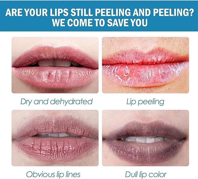 2pcs Lip Lightening for Dark Lips Lip Brightener for Smokers Dark Lip Treatment Lightening Cream for Pink Lips Lip Lightener for Smoker Lips Lip Lightening balm for Men and Women (Green)