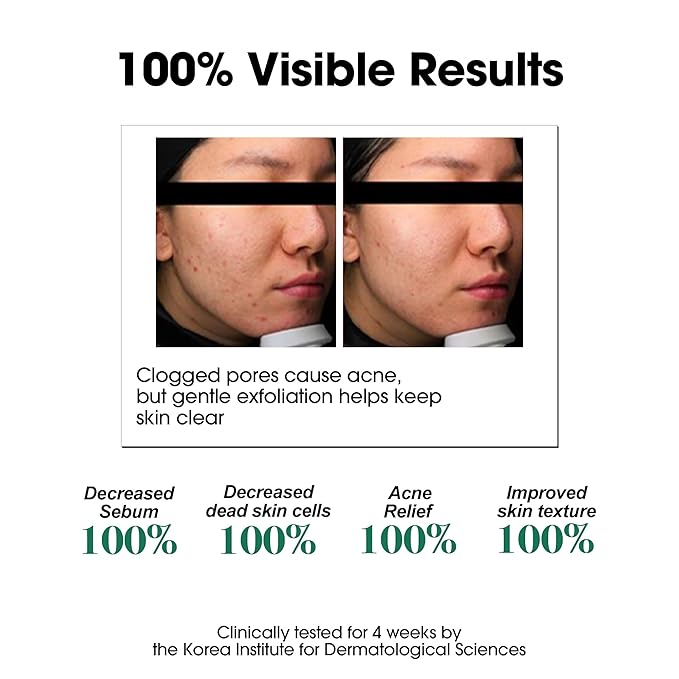 SOME BY MI AHA BHA PHA 30 Days Miracle Toner – Pack of 2 – Korean Salicylic Acid Exfoliating Face Toner for All Skin Types – Daily Pore Care & Oil Control with 2% Niacinamide – Korean Skin Care