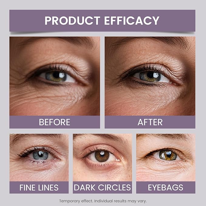 Lynz Pure Instant Eye Tightener, Temporary Firming Eye Cream & Makeup Primer, Smoothes Fine Lines & Minimizes Pores, No Filter Eye Primer 1 Fl Oz