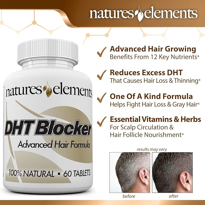 Natures Elements DHT Blocker – Herbal Formula with Saw Palmetto, Fo-Ti & Beta-Sitosterol – Supports Hair Regrowth & Gray Hair Reversal – Non-GMO, Vegetarian - 60 Tablets - Pack of 3