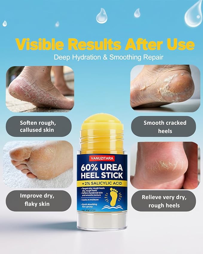 Urea Cream 60% with 2% Salicylic Acid, Foot Cream 60 Percent for Feet & Hands, Maximum Strength Urea Stick for Rough, Dry Cracked Feet Hands Elbows, Callus Remover, Skin Softener Balm 1.41oz