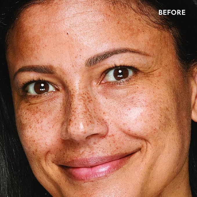 YENSA Super Serum Silk Concealer - Full Coverage Undereye Concealer & Peptides Serum for Face - Enriched with Vitamins C & E, Bakuchiol & Superfoods to Boost Radiance - Medium 2 (0.2 Fl oz)