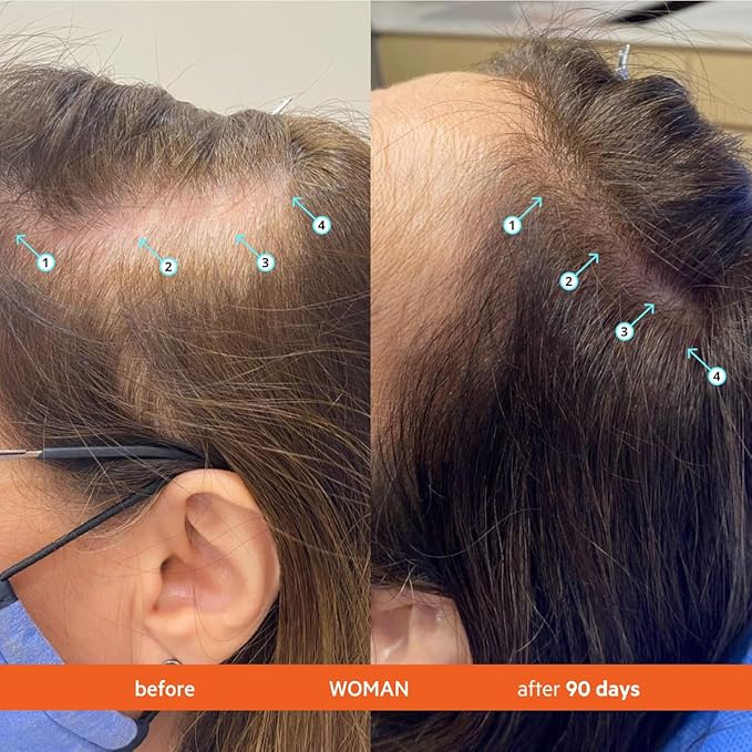 DS Labs Revita Shampoo, 205mL - Densifying & Volumizing Shampoo for the Appearance of Fuller, Thicker Hair, Gentle for Daily Use, (2 Pack)