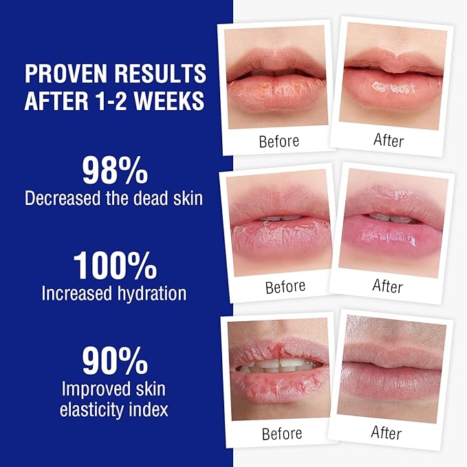 Lip Balm Treatment with Beeswax, Peppermint Chapping