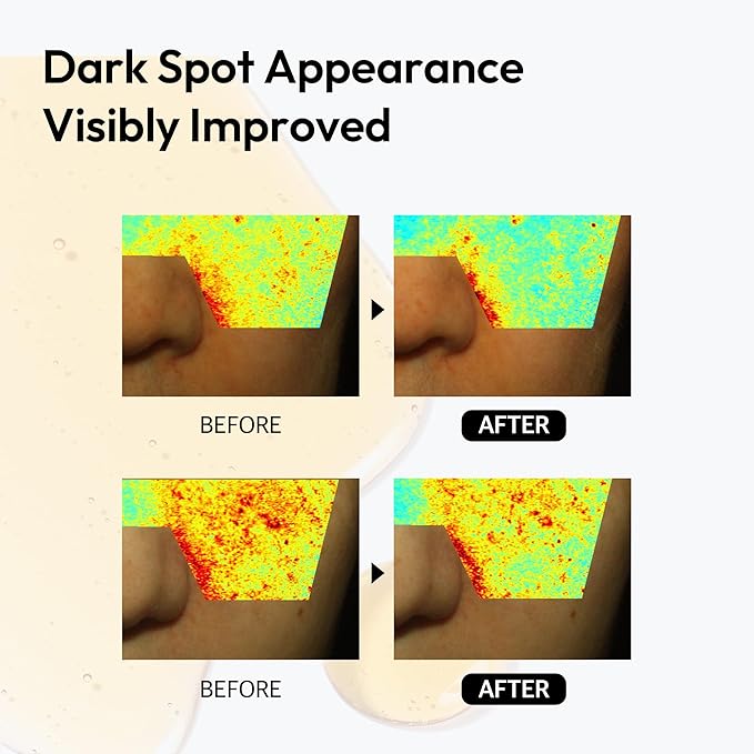 LAYERLAB 10% Vitamin C Radiance Serum with Resveratrol & Vitamin E | Potent Antioxidant Formula for a Visibly Brighter, Even-Looking Complexion | Hydrating K-Beauty Skincare (0.94 fl oz)