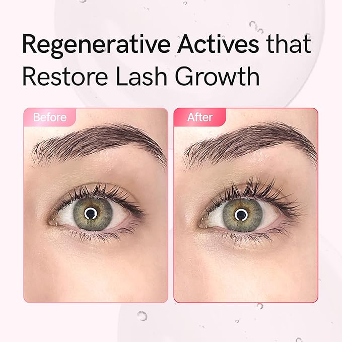 Lash Serum for Damaged, Thin or Extension-Weakened Lashes | Eyelash & Brow Growth Serum with PDRN, EGF, 20 Amino Acids & 9 Peptides | Gentle Korean Formula, Prostaglandin-Free (0.3fl oz)