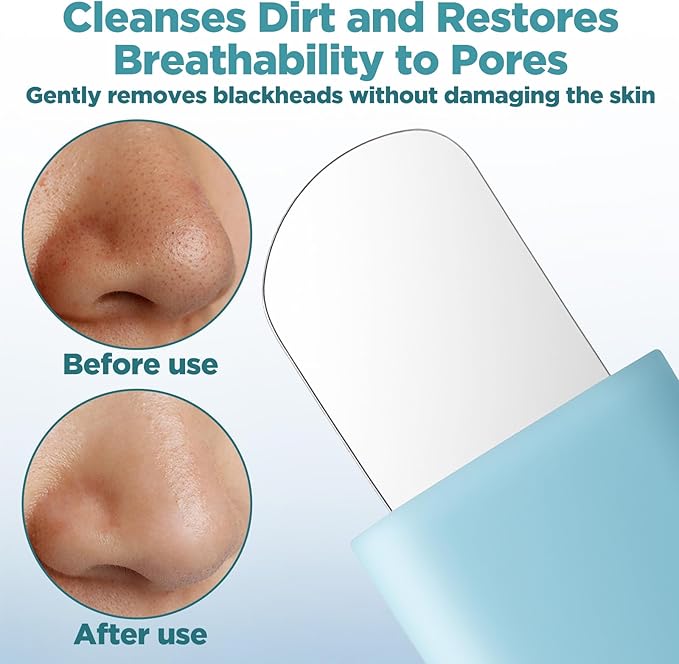 Face Scrubber Pore Cleaning Brush Face Mask Applicator Skin Care Tool for Men Women Deep Cleansing(Blue)