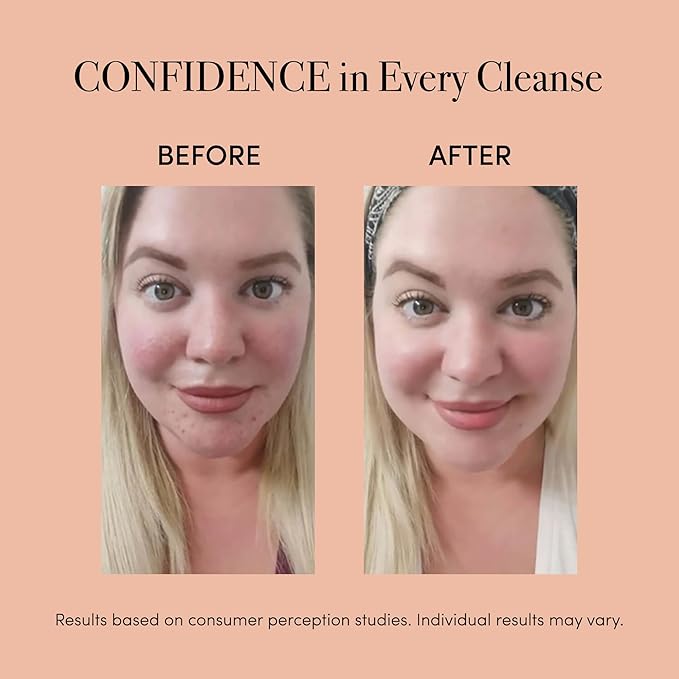 reVive Light Therapy Lux Collection Spot Acne Device, Portable Red & Blue Light LED Therapy Products for Blemish-Prone Skin, Rechargeable, On-The-Go Face Tools for Skincare