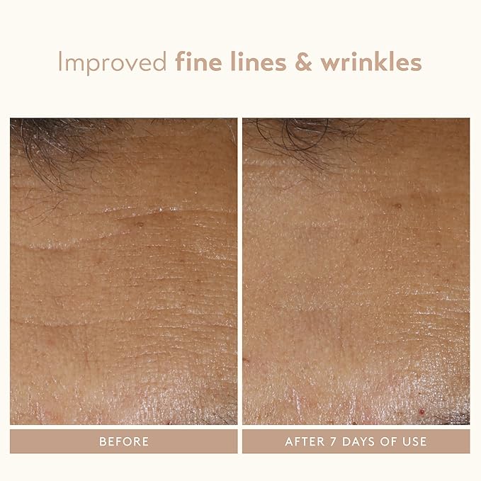 SHANI DARDEN SKIN CARE Facial Sculpting Wand, Neck Firming and Tightening Device, Anti-Aging Sound Wave Device to Target Wrinkles, For Eyes, Lips and Face, 1 Count