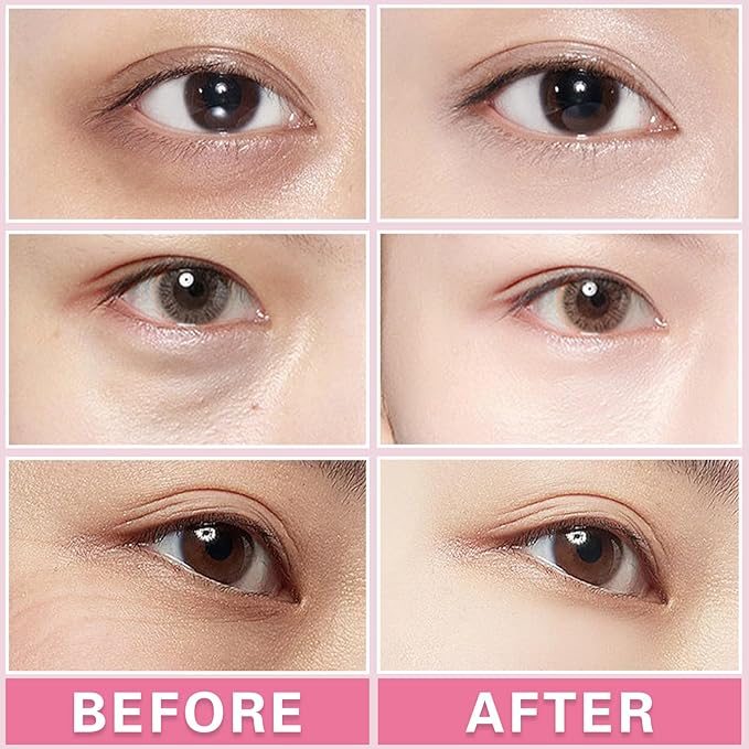 2PCS Under Eye Cream Lift Firm Skin Around the Eyes