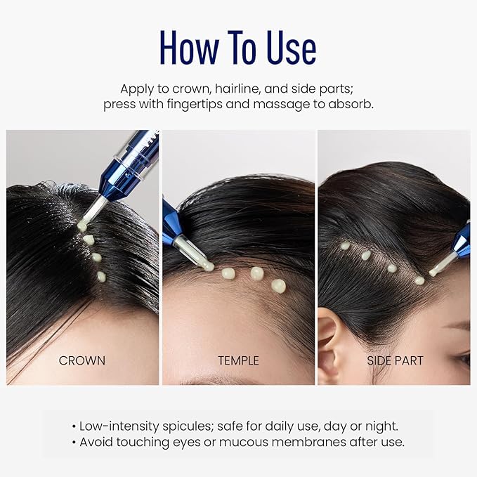 ViveLab Scalp Microneedle Serum – K-beauty Hair Growth & Scalp Treatment with Spioxyl™ 400 | Fills Hair Part Line, Strengthens Roots, Reduces Hair Thinning – 220,000 Microneedle Formula