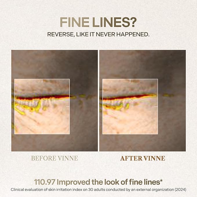 VINNE Signature Bio Deep Collagen Firming Mask – Korean Hydrogel Mask w/ 5,000ppm Ultra-Low Molecular Collagen, Centella Asiatica Exosome, Niacinamide & PDRN – Skin Care Face Mask (4 Sheets, 1.41 oz)