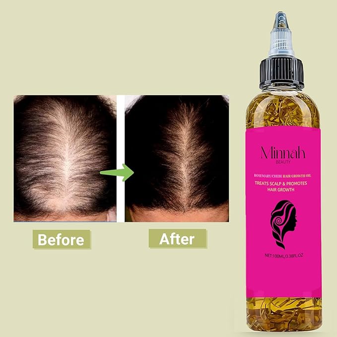 Minnah Batana Oil for Hair Growth, crack hair growth oil 4-in-1 Liquid Batana Oil, with Rosemary, Pumpkin Seed, Castor (1pcs)