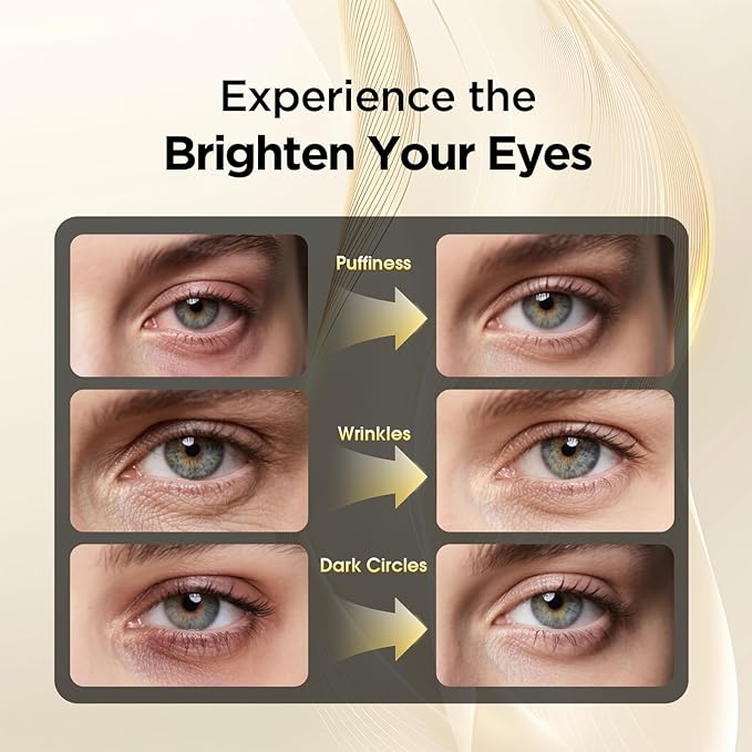 Retinol Eye Cream for Dark Circles and Puffiness – Hydrating Eye Serum for Wrinkles and Fine Lines, Anti-Aging Under eye Cream for Women, 0.71 fl oz