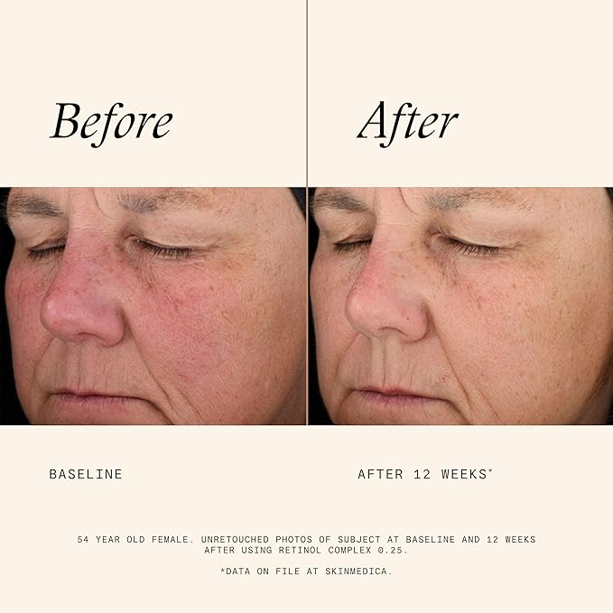 SkinMedica Retinol 0.25 Complex - Retinol Serum for Face, Age-Defying Advanced Retinol Cream That Renews Skin and Diminishes the Appearance of Fine Lines and Wrinkles, 1 Fl Oz