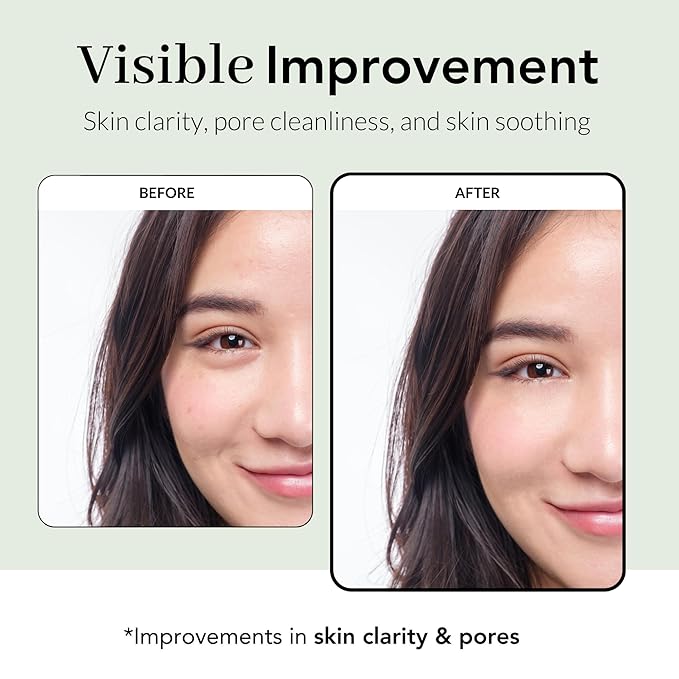 NOWATER Tea Tree Wrapping Mask, Skin Soothing care & Acne-prone Skin - Teatree & 6 Tropical Fruit Extracts, Calming Peel Off Mask, Korean Skincare for Face (2.4 Oz)