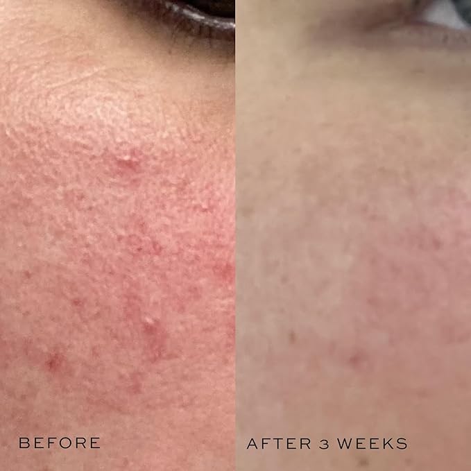 DIME Beauty Mini Super Skin Toner, Alcohol-Free Witch Hazel Toner, Travel-Size Toner with Cucumber Extract, 2 oz / 60 ml