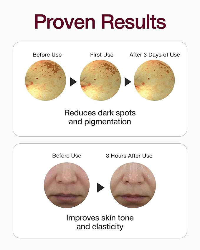 Centellian 24 Expert Madeca Mela Capture Ampoule Max (Madeca Mela 0.5fl oz) High Concentration Serum for Melanin Reduction, Wrinkle & Enhanced Skin Elasticity - TECA Centella Asiatica Extract