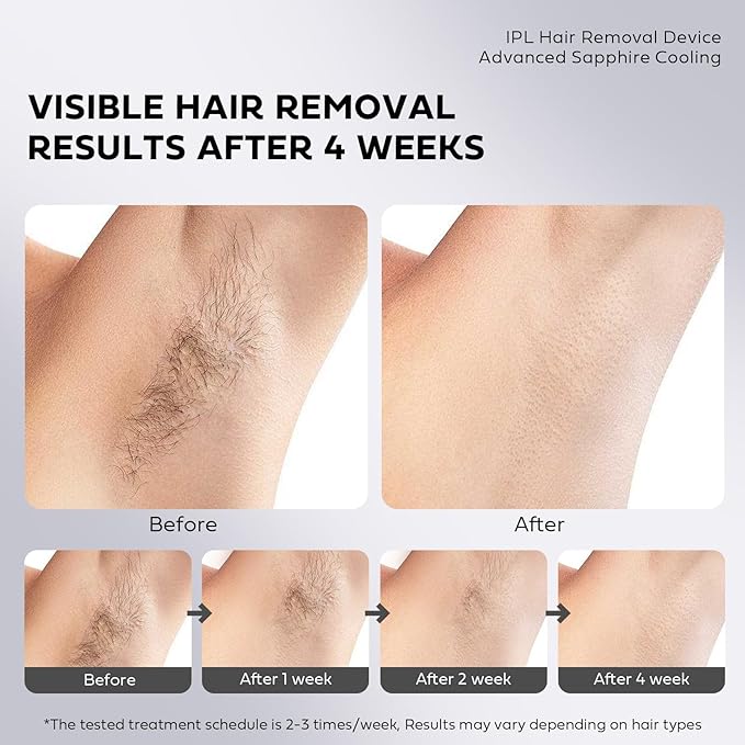 Laser Hair Removal with Ice Cooling, IPL Hair Removal Device Painless, EUARNE Home Use Facial Hair Removal for Women, Dual Lights, Effective in 2 Weeks, Body & Face Epilator, Storage Bag for Travel.