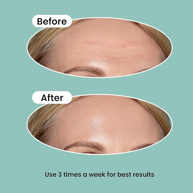 Advanced Wrinkle Patches 60ct Smile Line, Frown Line Wrinkle Patches for Facial Korean Skin Care Face Wrinkle Tape Invisible Overnight with Retinol & Collagen (Large (Forehead))