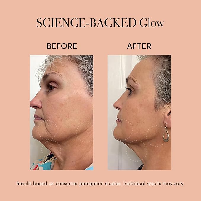 reVive Lux Collection Glo Aging & Acne Device, FDA-Cleared & Medspa-Quality Blue Light, Red, Amber & Infrared Acne Tools, Science-Backed LED Light Therapy Products