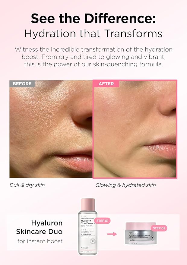 Hanskin Hyaluron Skin Essence, Hydrating Facial Astringent Toner for Dry, Dull, Sensitive Skin - Hyaluronic Acid Collagen Moisturizing Purifying Paraben-Free Korean Skincare [5.07 fl. oz.]