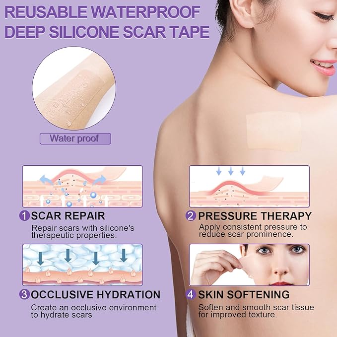 Silicone Scar Sheets, Medical Grade Silicone