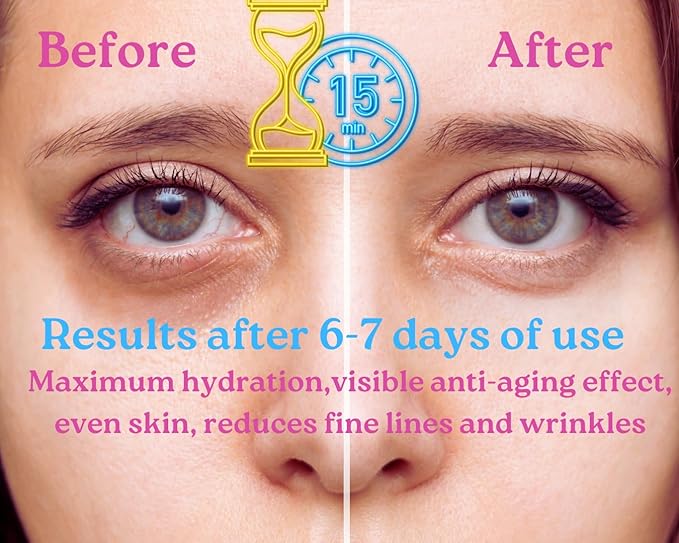 Under Eye Patches, Eye Masks, Under Eye Patches for Puffy Eyes and Dark Circles, Under Eye Mask, Under Eye Patches Dark Circles