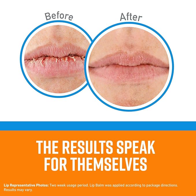 O'Keeffe's Cooling Relief Lip Repair Lip Lips,